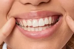 Dentes - Imagem ilustrativa